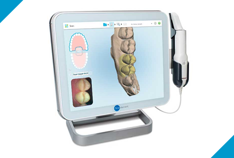 3D光学スキャナーで矯正後のイメージ